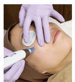 施術で使用する機器